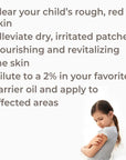 Plant Therapy Skin Soother KidSafe Essential Oil