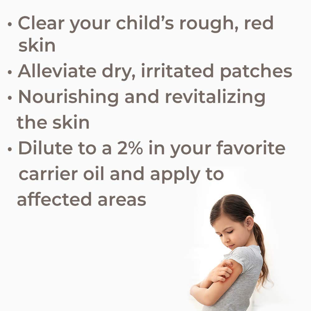Plant Therapy Skin Soother KidSafe Essential Oil